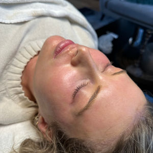 Dermapen4