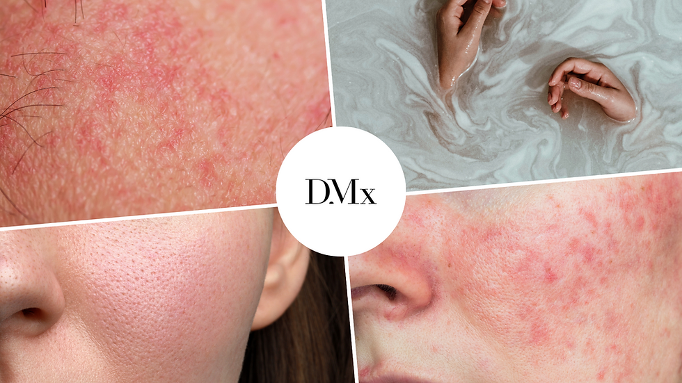 irritación de la piel