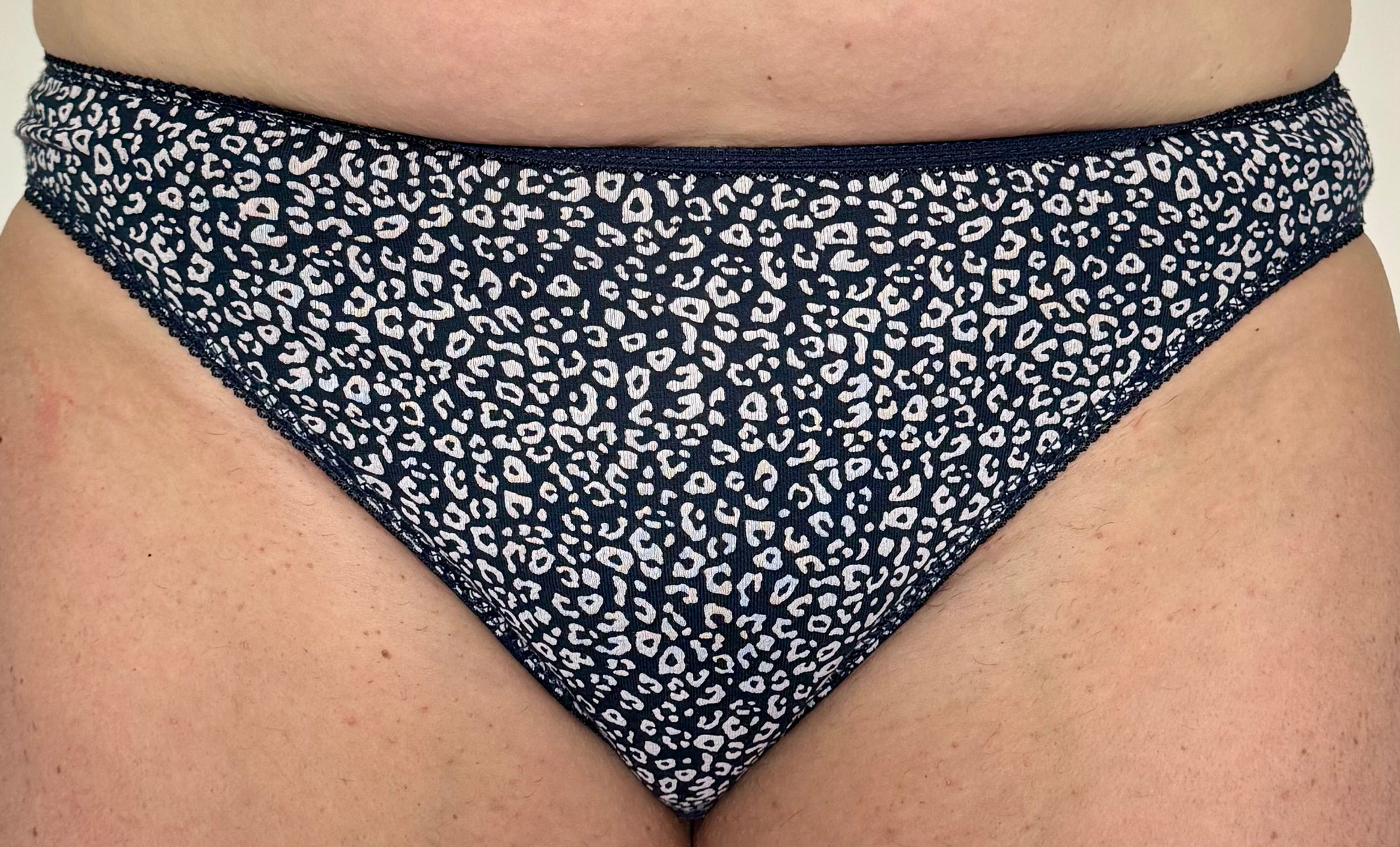 Blue White Pattern High Leg Knickers