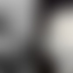 Side-by-side comparison of Joseph Merrick and a 3D scan of his skull, displaying the severe skeletal deformities of the Elephant Man.