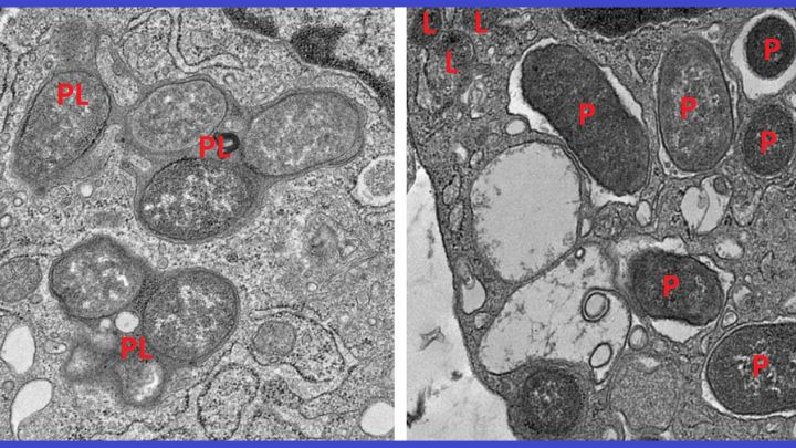 Transmission electron micrograph comparing normal bacteria (PL) and pathogenic bacteria (P) inside host cells. Focus keyword: gut microbiome.