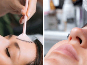 DIY Skincare vs. Professional Aesthetic Treatments: What’s Best for You?