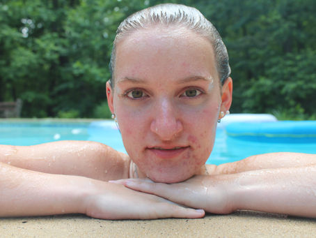 The Start of Saying Goodbye (TO ACNE!!!)