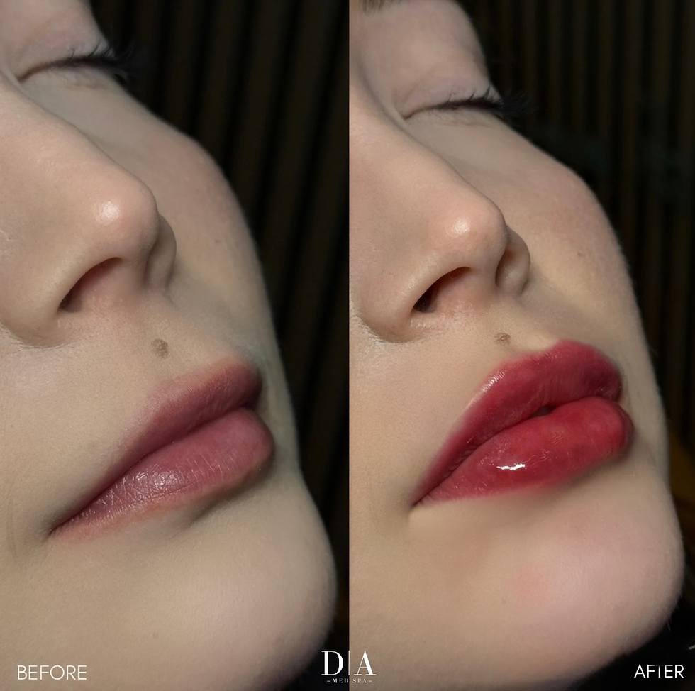 Understanding Lip Filler: What It Is, How It Works, and What to Expect
