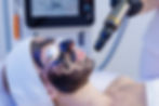 laser-carbon-peeling-facial-procedure-for-skin-rej-2025-07-22-20-47-30-utc.jpg