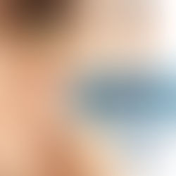 Icterícia é sinal de câncer?