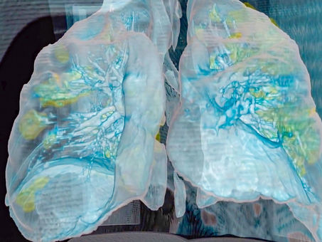 Cuando el virus entra puede viajar por la traquea hacia los pulmones y volverse mortal