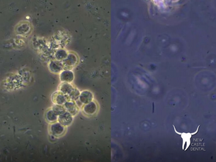 Do You Know What is Inside Your Mouth?