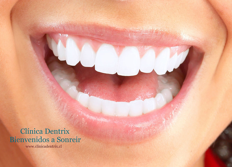 Estética Dental