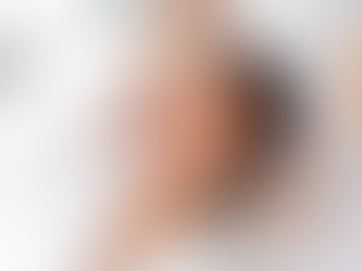 Everything You Need to Know About Hyperpigmentation on the Face