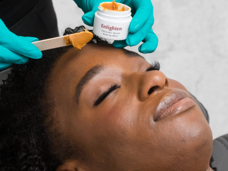 Why the ReveSkin Enlighten Peel Is Houston's #1 Chemical Peel for Hyperpigmentation & Glowing Skin
