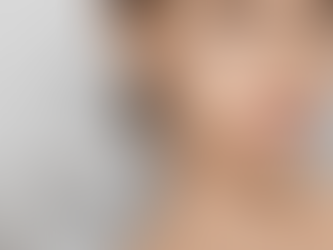 How to Maximize Your Botox Results: A Professional's Guide to Aftercare and Maintenance