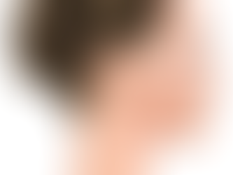 Say Goodbye to Jaw Tension: How Masseter Botox Can Help with Teeth Grinding and Clenching