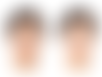 Face Slimming Without Surgery? Here’s How Masseter Botox Can Reshape Your Jawline