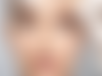 How Often Should You Get Botox Touch-Ups?