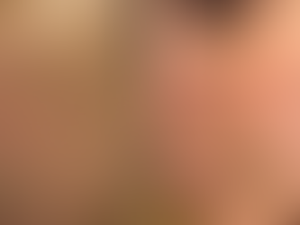 How to Fade Acne Scars and Improve Textured Skin with Microneedling and Chemical Peels: The Complete Guide