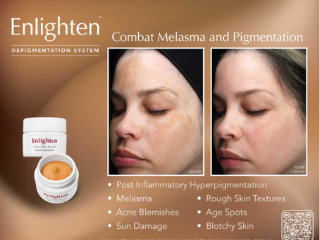 Enlighten Peel by ReveSkin