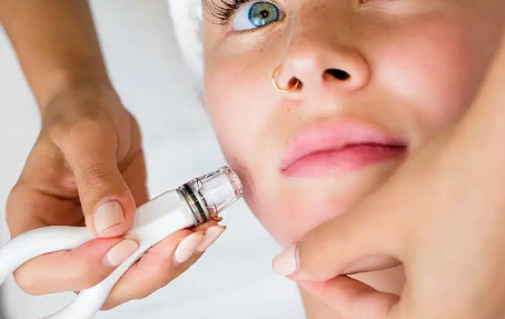 An Update to Our Dermaplaning + Dermalinfusion Facial Pricing