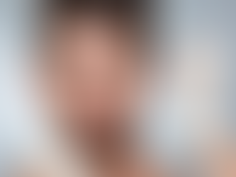 Botox Maintenance: How Often Should You Come Back for Treatments?