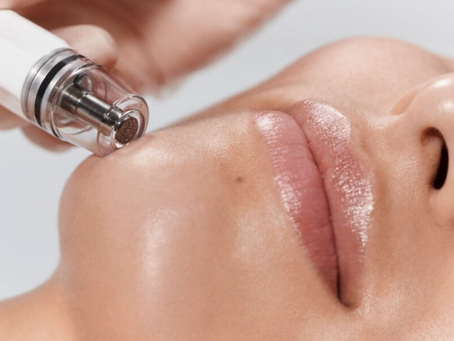 Our Most Popular Facial: Dermaplaning + Dermalinfusion