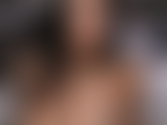 The Power of Salmon Sperm in Skin Treatments: Why It’s a Game Changer for Microneedling, Venus Viva, and Explore RF at Hi Beautiful Aesthetics