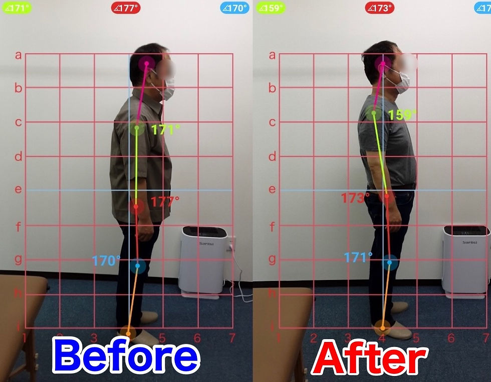 【当院が行う姿勢改善について】