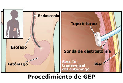 Heridas, Ostomías, Drenajes - Dra. Wong
