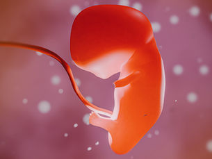 Avanço Científico | O Sangue do Cordão Umbilical e o Autismo