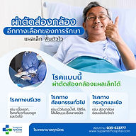 แผลเล็ก เจ็บน้อย ผ่าตัดส่องกล้อง ทางเลือกของการรักษา ที่ โรงพยาบาลศุภมิตร 🔍✨ ช่วยให้การฟื้นตัวเป็นไปได้อย่างรวดเร็ว ในหลายกรณี แผลเล็กทำให้การฟื้นตัวง่ายขึ้น กลับไปใช้ชีวิตประจำวันง่ายขึ้น