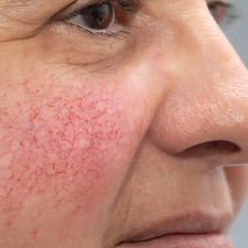 Women-Cheeks-1-min-1024x533.jpg