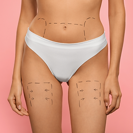 RF Skin Tightening Thumbnail