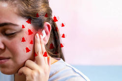 Understanding Notch Therapy: A Breakthrough in Tinnitus Relief with Signia Hearing Aids