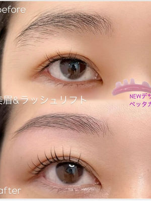 NEWロッド