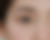 Asian eyelid showing double lid