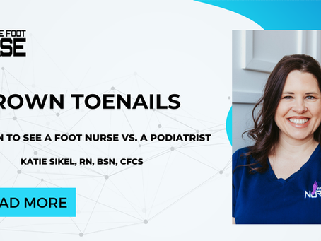 Ingrown Nails - When to See a Foot Nurse