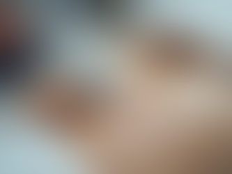 Achieve Smooth Skin with Laser Hair Removal