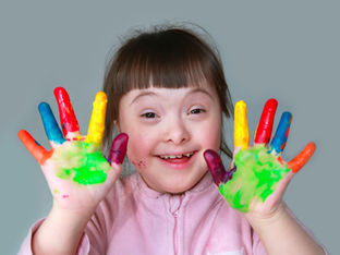Know About Down Syndrome