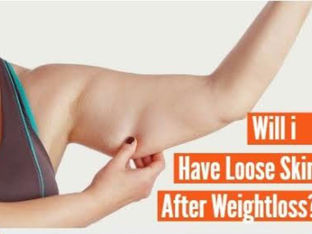 Weight Loss: How To Take Care Of Loose, Sagging Skin After Losing Weight