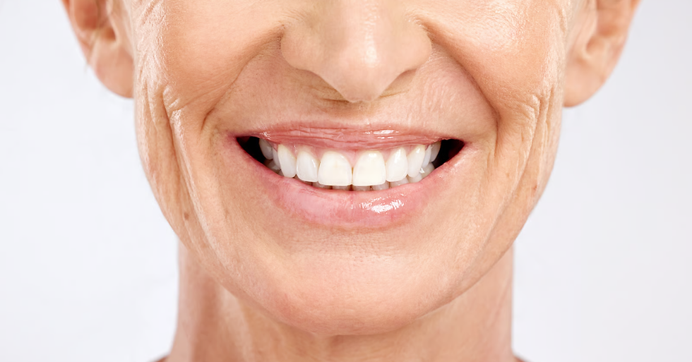 After image showing dentures restoring a full smile.png