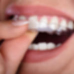 Irvington Invisalign.jpg