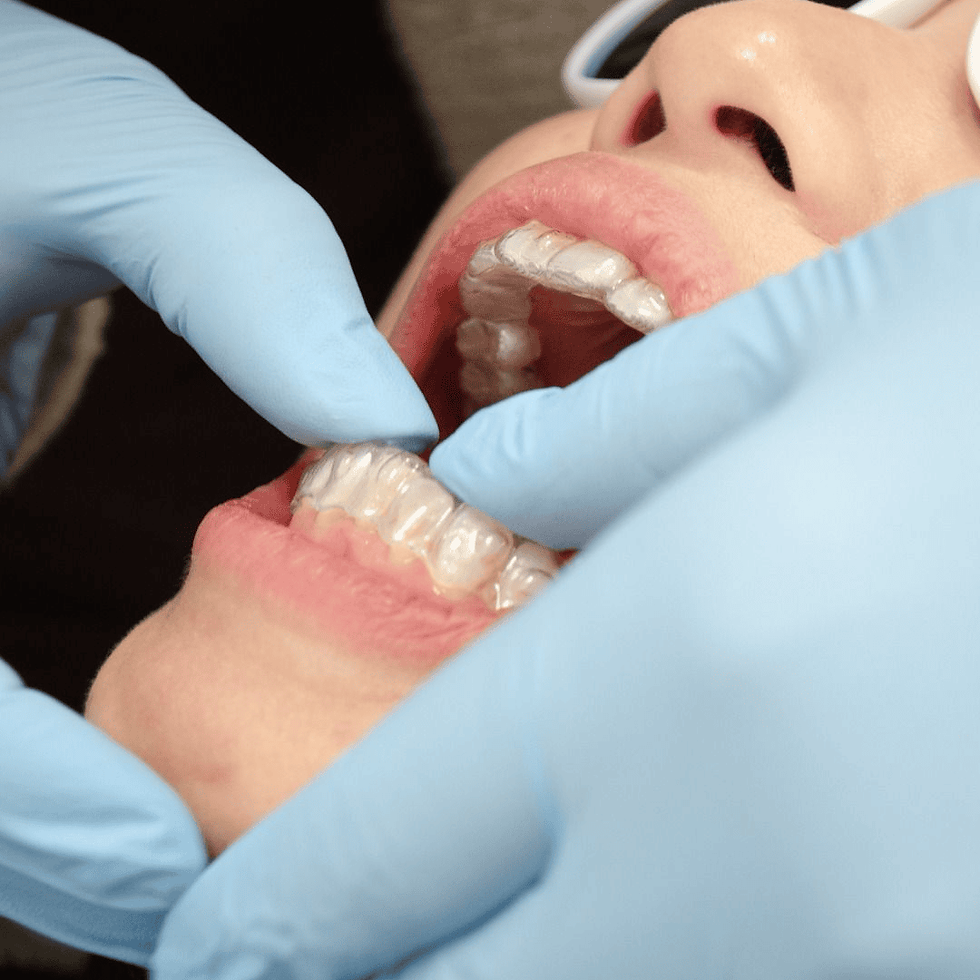 Female patient displaying aligned teeth after Invisalign.png
