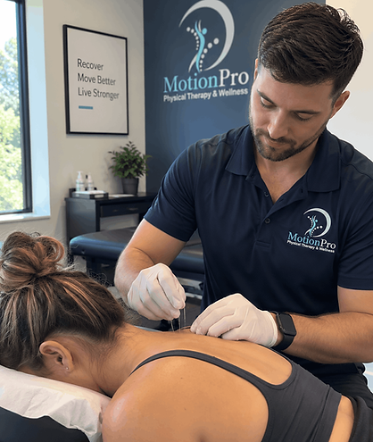 MotionPro physical therapist performing dry needling on a patient’s upper back to relieve muscle tension and pain in West Palm Beach.