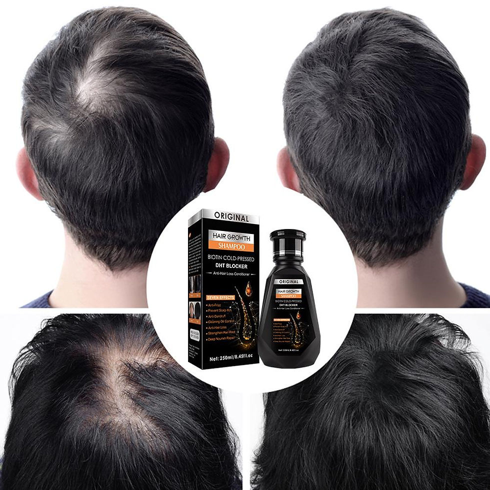 Thumbnail: 250ML Biotin Shampoo For Hair Growth And Thinning Hair – Ginger Shampoo Thicke