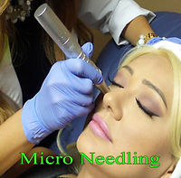 micro-needling.jpg