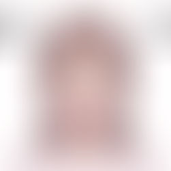 手術後の顔面神経麻痺