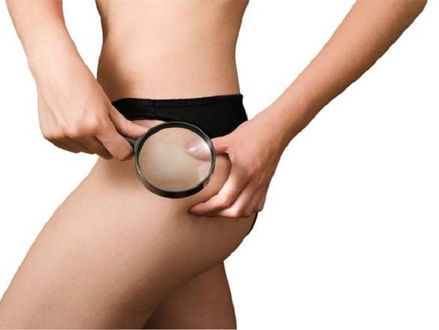 ALERTA: Mulheres colocam até 12 litros de silicone industrial, proibido e letal