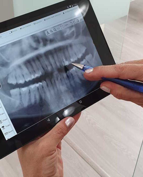 Clinica_dental_barcelona_somriu_amb_gracia_7.jpeg