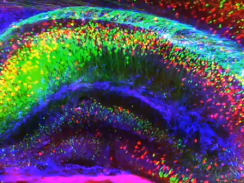See-Through Brains