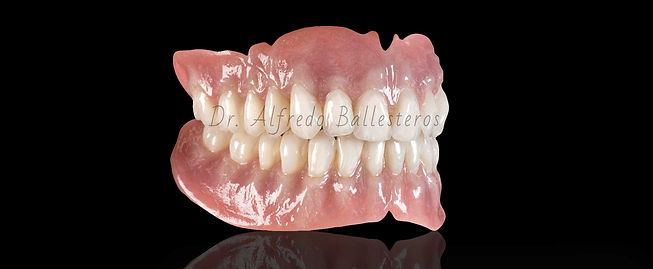 Full Denture Example Dr Ballesteros Mexi