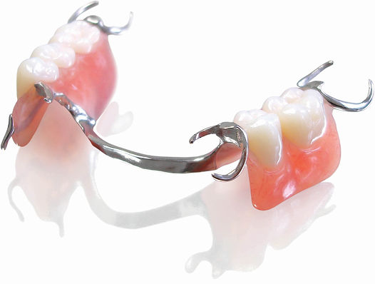 Partial Denture in Mexicali Dr Ballesteros